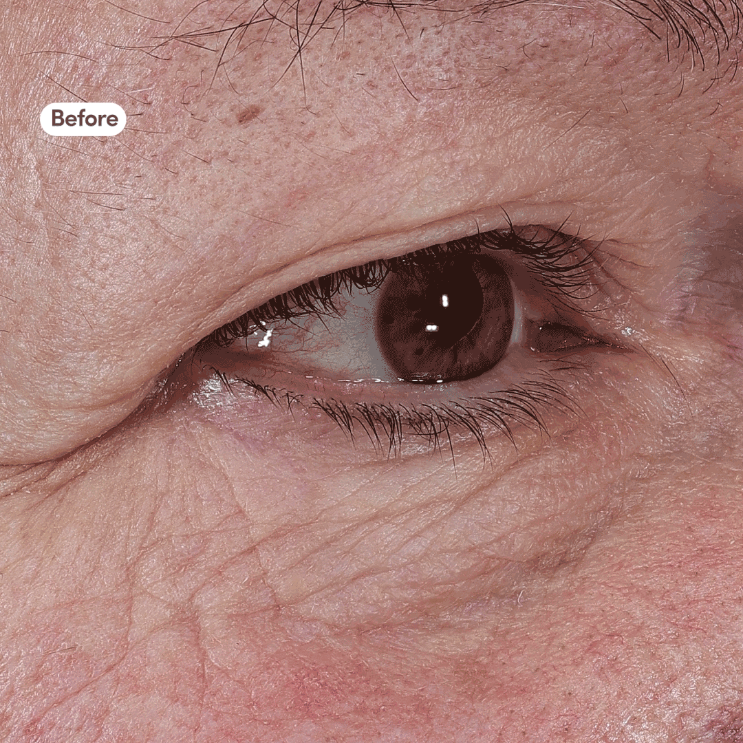 Miniprotein™ Eye Treatment - Take Back Time Eye Treatment - GLAM MODA