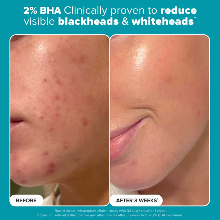 Multi-Level Exfoliation Kit - GLAM MODA