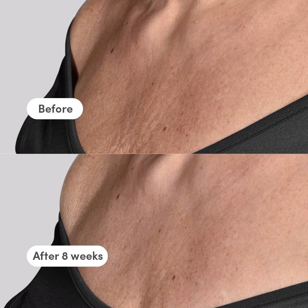 Neck/Décolleté Concentrate - The Elevator - GLAM MODA