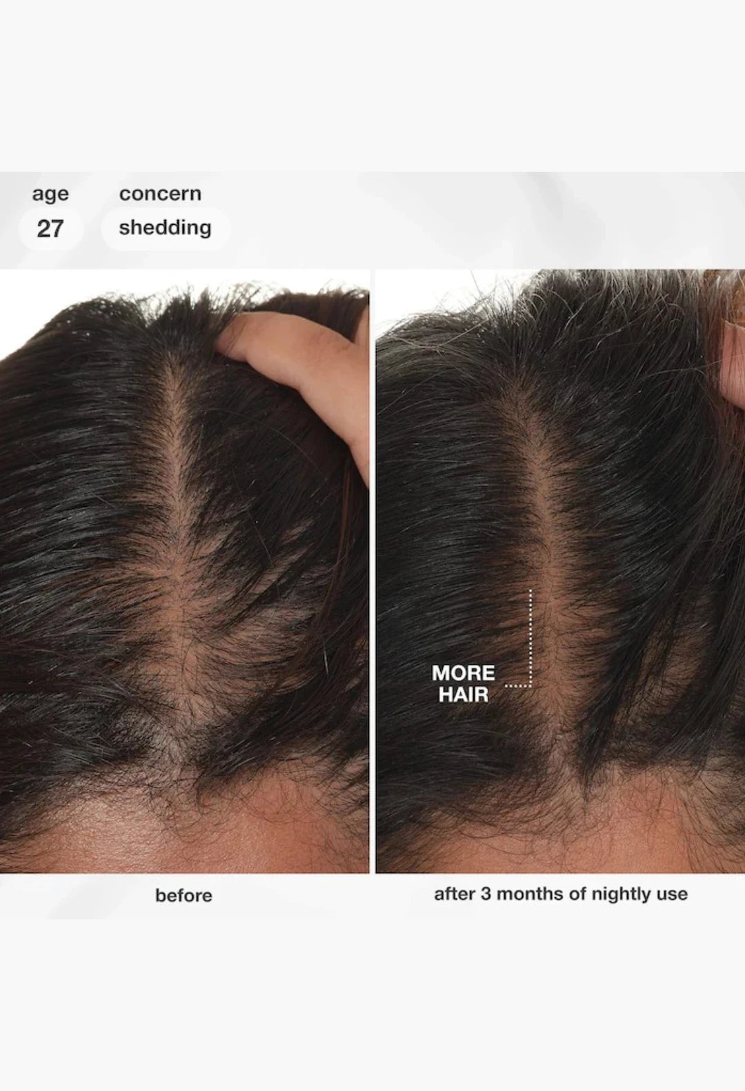 FutureIQ™ Hair Longevity Serum for Graying, Thinning, & Scalp Aging