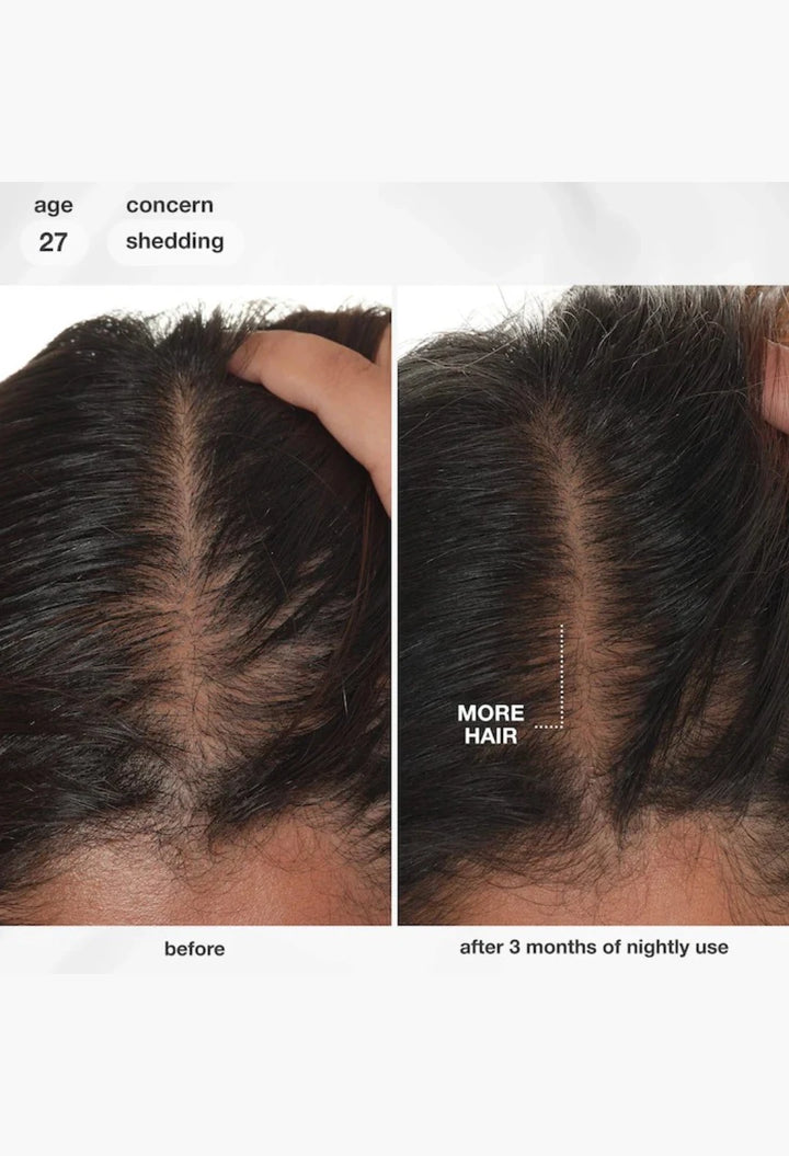 FutureIQ™ Hair Longevity Serum for Graying, Thinning, & Scalp Aging