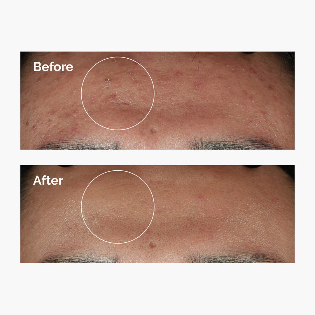 Niacinamide 10% + Zinc 1% - GLAM MODA