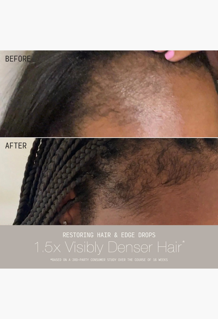 GLAM MODA before and after results of hair edge restoration showing fuller hair growth along the hairline