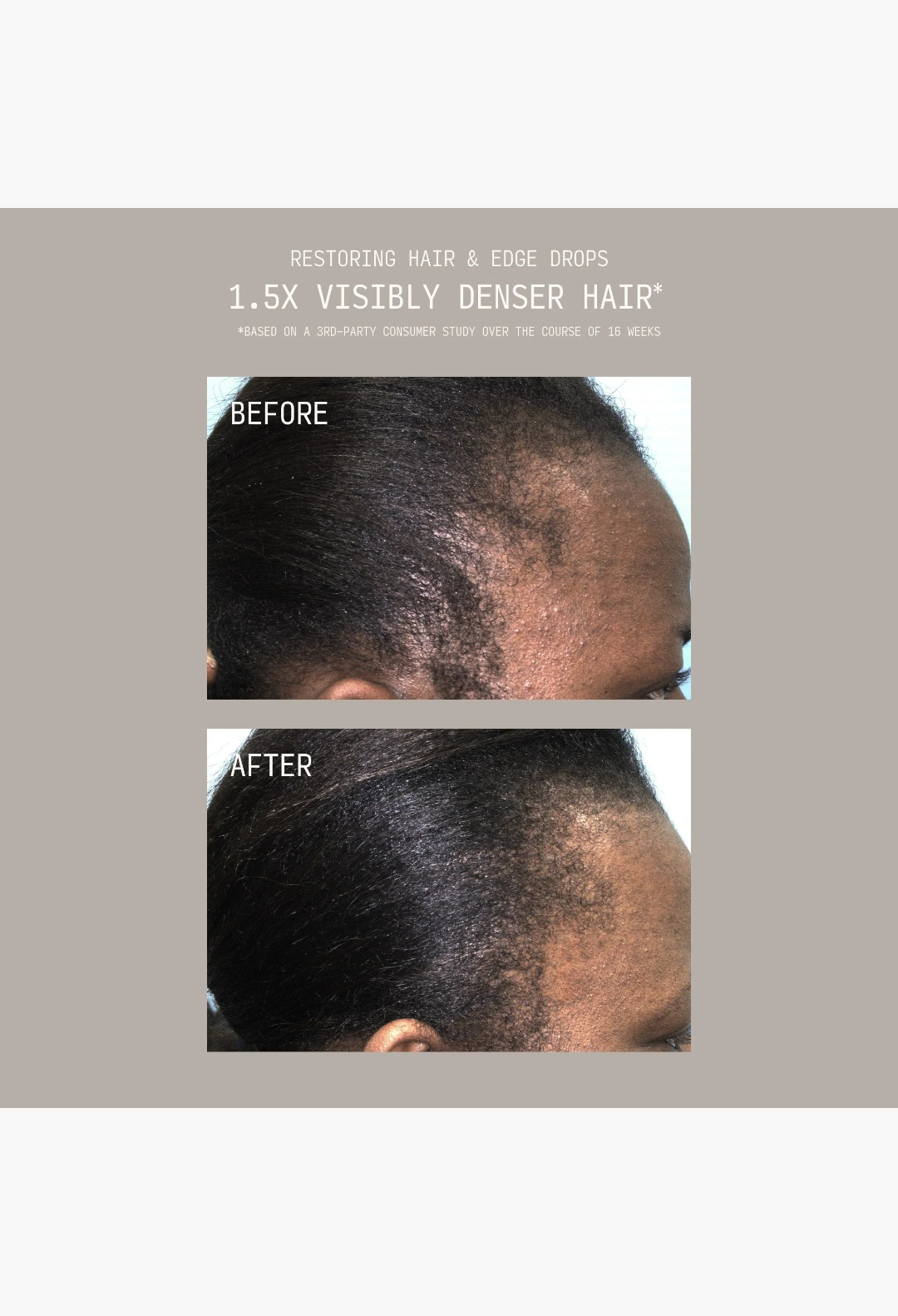 GLAM MODA before and after results showing improved hair density and edge growth on a person with thinning hair.