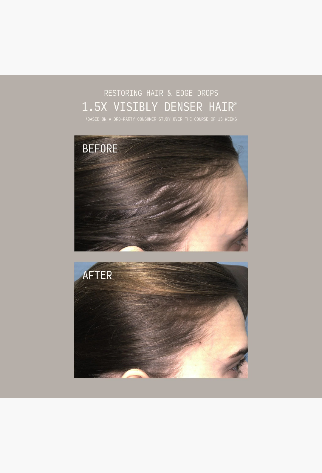 GLAM MODA before and after comparison showing improved hair density and scalp coverage after using hair drops.