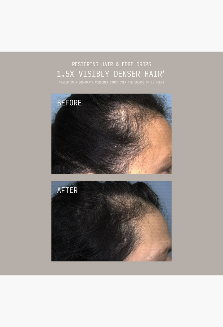 GLAM MODA before and after results showing improved hair density and reduced thinning on the scalp and hairline.