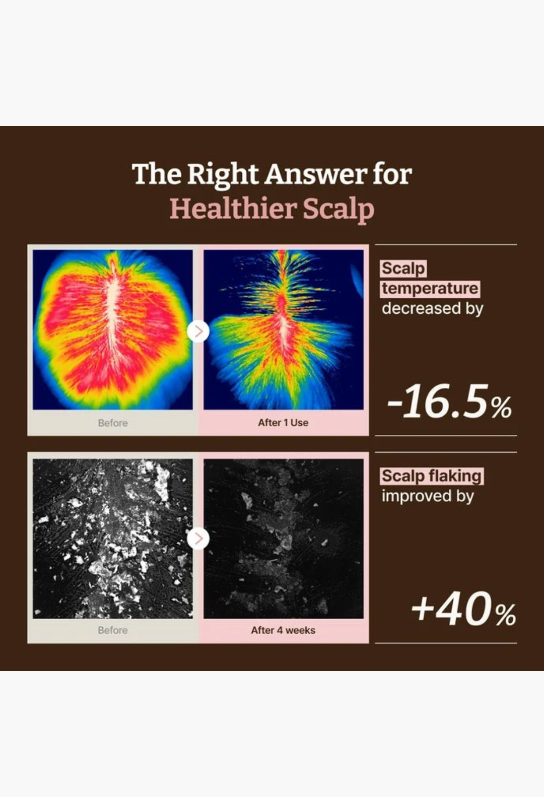 GLAM MODA Advanced PDRN Hair Density Scalp Serum clinical results showing reduced scalp temperature and flaking.