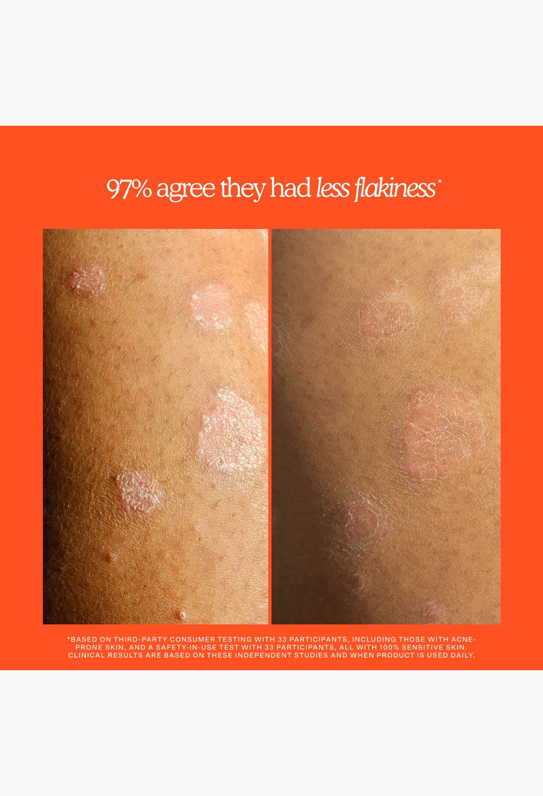 Tower 28 Beauty SOS Rescue + Relief Body Wash Treatment