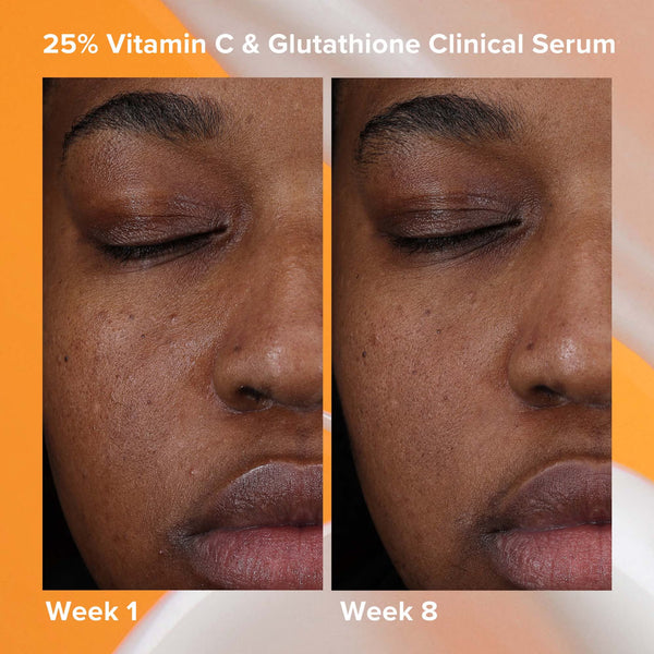 25% Vitamin C+ Glutathione Clinical Serum 30ml