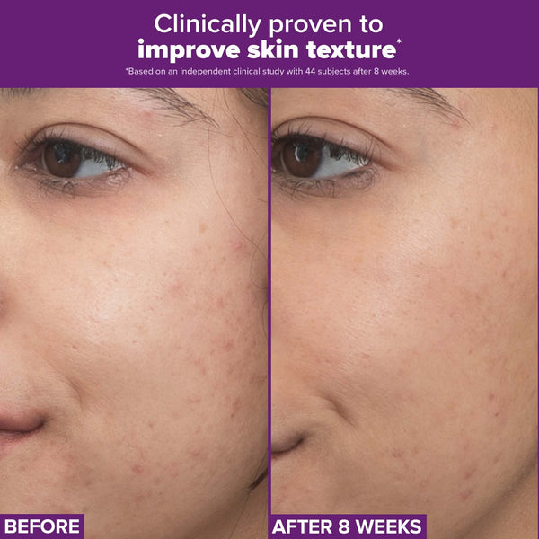 Clinical Pro Retinaldehyde Dual-Retinoid Treatment 30ml
