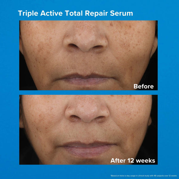 Triple Active Total Repair Serum 30ml