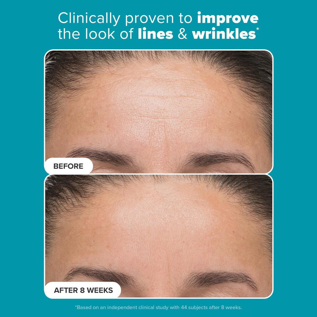 Perfecting 6% Mandelic Acid and 2% Lactic Acid Liquid Exfoliant 88ml - GLAM MODA