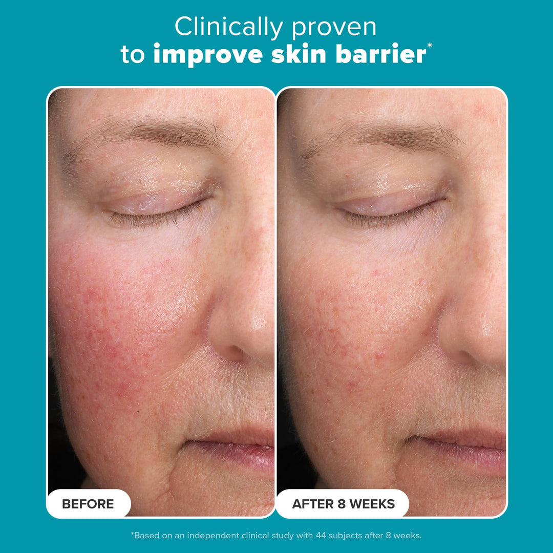 Perfecting 6% Mandelic Acid and 2% Lactic Acid Liquid Exfoliant 88ml - GLAM MODA