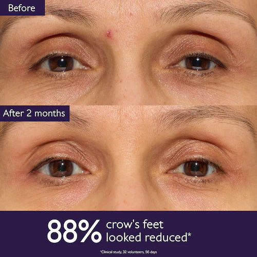 Premier Cru Anti-Aging Eye Cream for Fine Lines and Wrinkles - GLAM MODA