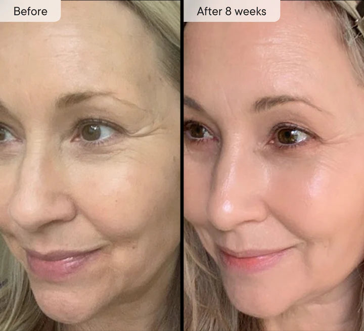 Refresh The Appearance Of Your Skin With Our Light Therapy Mask - Red Light Mask Q-Rejuvalight Pro - GLAM MODA