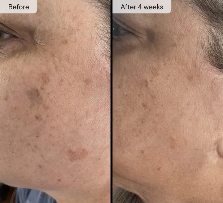 Refresh The Appearance Of Your Skin With Our Light Therapy Mask - Red Light Mask Q-Rejuvalight Pro - GLAM MODA