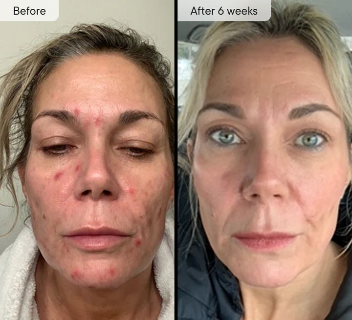 Refresh The Appearance Of Your Skin With Our Light Therapy Mask - Red Light Mask Q-Rejuvalight Pro - GLAM MODA