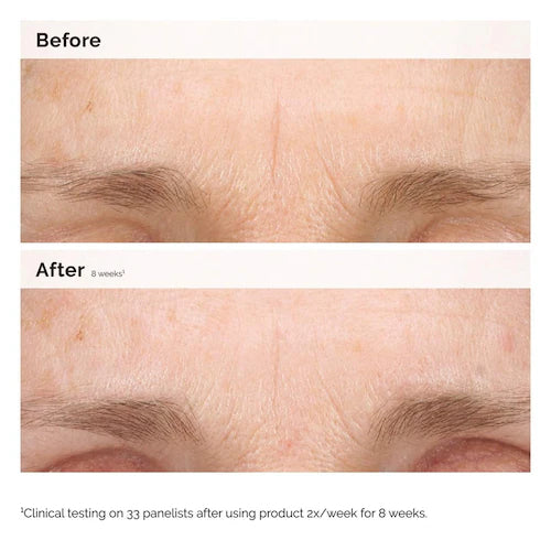 Retinal 0.2% Emulsion High-Strength Retinoid Nighttime Treatment - GLAM MODA