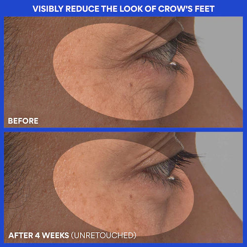 Retinol Green Tea PDRN™ Firming & Smoothing Serum - GLAM MODA