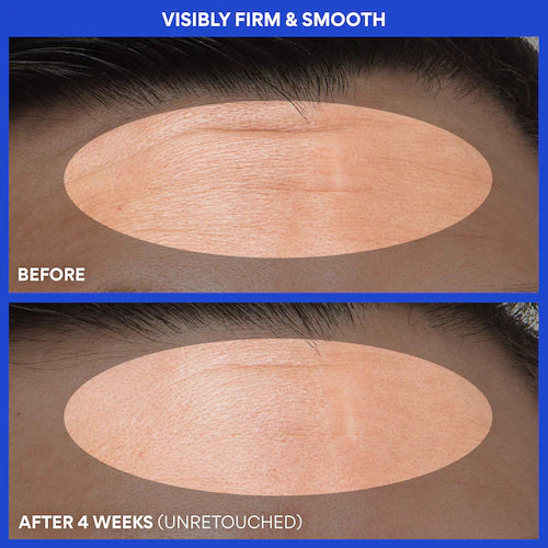 Retinol Green Tea PDRN™ Firming & Smoothing Serum - GLAM MODA