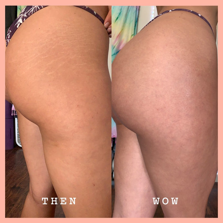 Rosehip Body Scrub & Cleanser - GLAM MODA