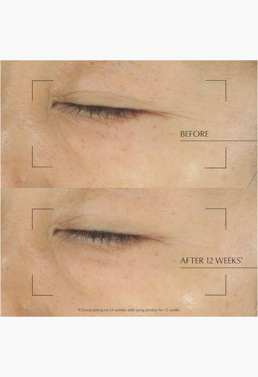 GLAM MODA clinical before and after comparison showing reduced skin lines and improved firmness after 12 weeks of use.