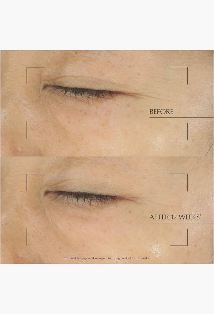 GLAM MODA clinical before and after comparison showing reduced skin lines and improved firmness after 12 weeks of use.