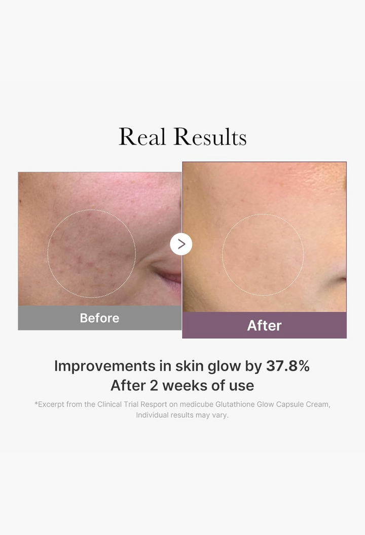GLAM MODA AGE-R Glutathione Glow Capsule Cream before and after skin results showing improved radiance and texture