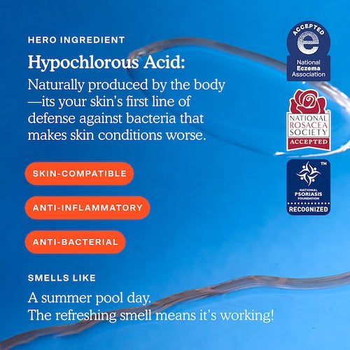 SOS Daily Hypochlorous Acid Spray for Breakouts & Redness - GLAM MODA