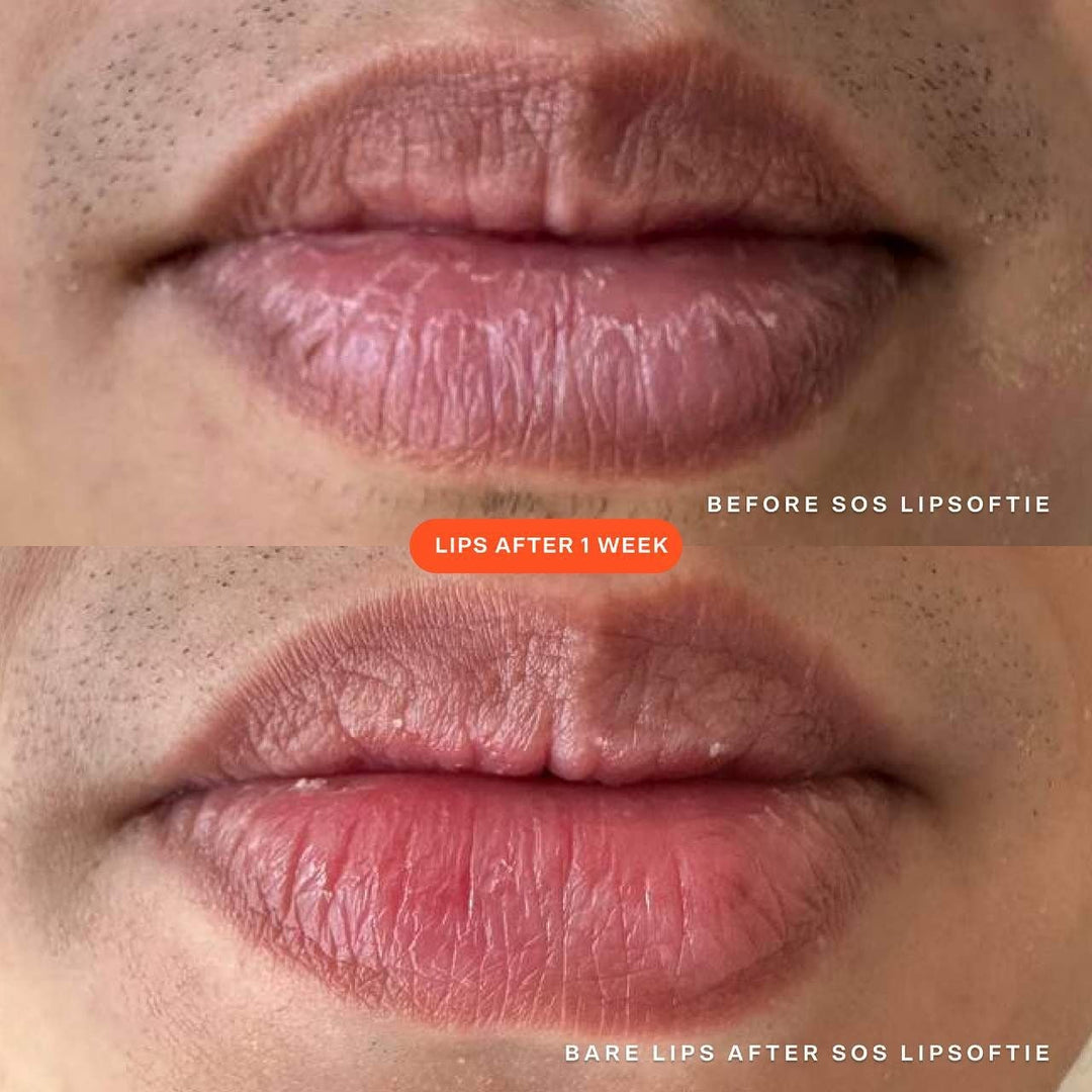 SOS Lip Softie Rescue lip treatment - GLAM MODA