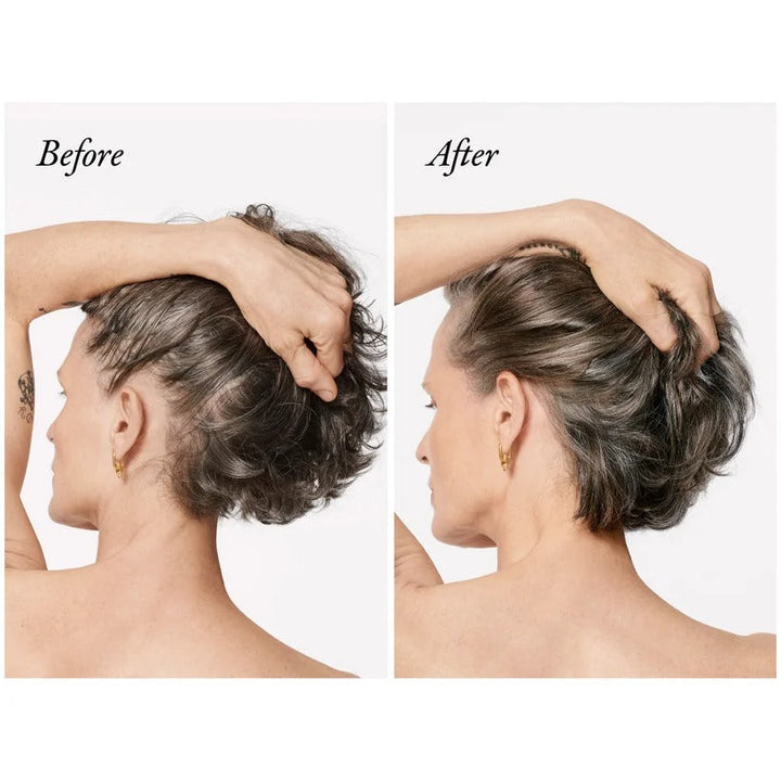 Serene Scalp Densifying Treatment Spray - GLAM MODA