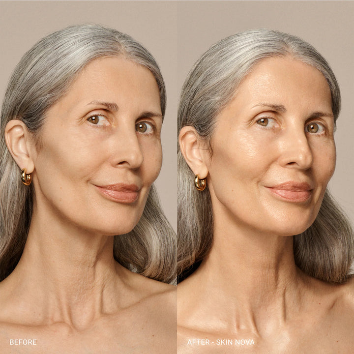 Skin Nova Xl - GLAM MODA