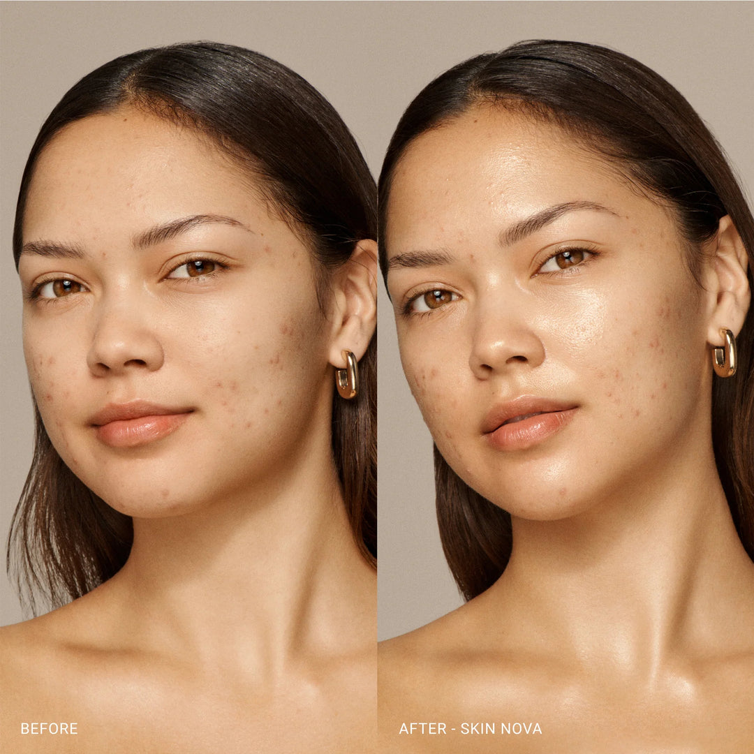 Vieve Skin Nova XL- Skin Nova XL Liquid - GLAM MODA