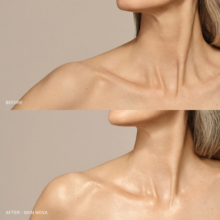 Skin Nova Xl - GLAM MODA