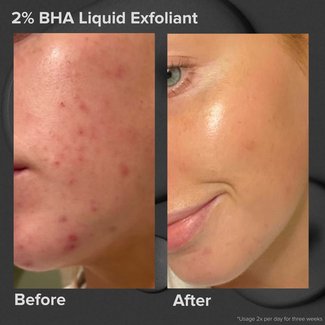 Skin Perfecting 2% BHA Liquid Exfoliant - GLAM MODA