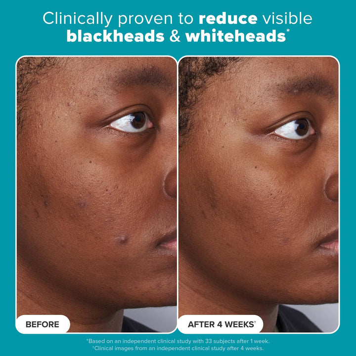 Skin Perfecting 2% BHA Liquid Exfoliant - GLAM MODA