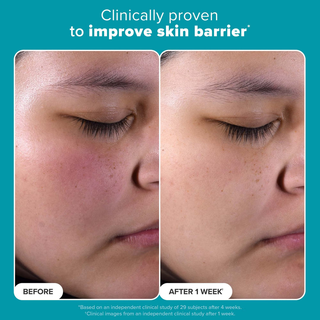 Skin Perfecting 2% BHA Liquid Exfoliant - GLAM MODA