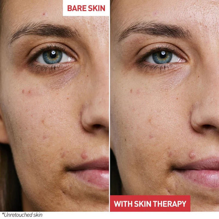 Skin Therapy Light - GLAM MODA