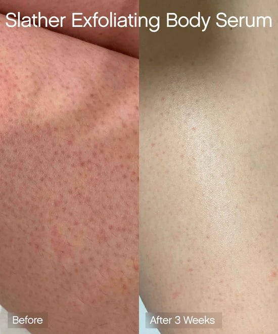 Slather Exfoliating Body Serum - GLAM MODA