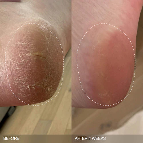 Slather Exfoliating & Smoothing Bar - For Soft Skin - GLAM MODA