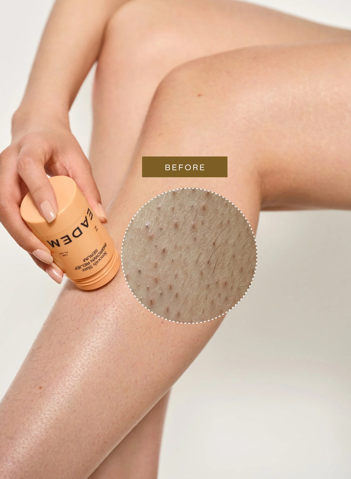 Smooth Slate Ingrown Relief Serum - GLAM MODA