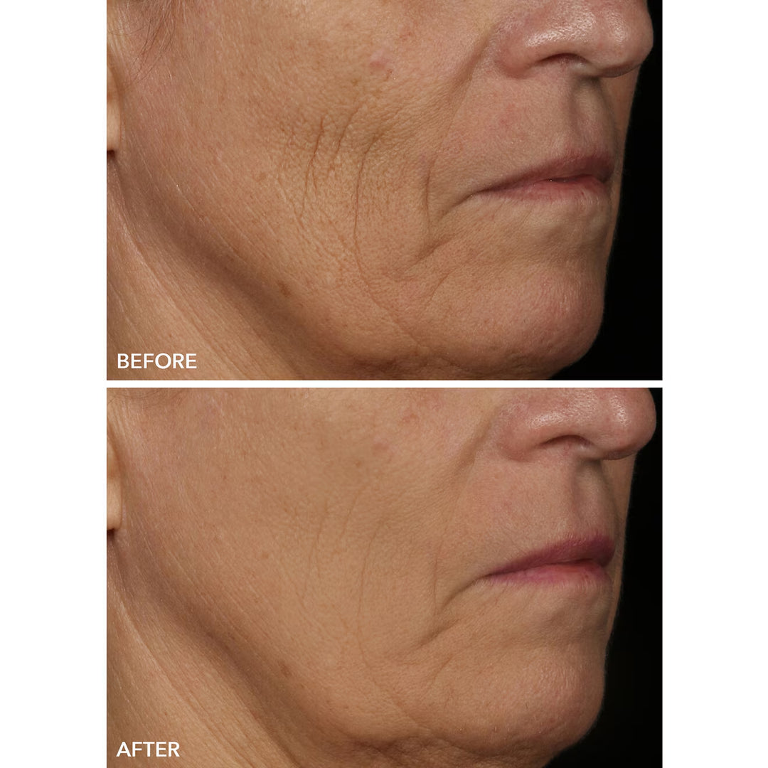 Spectralite FaceWare Pro - GLAM MODA