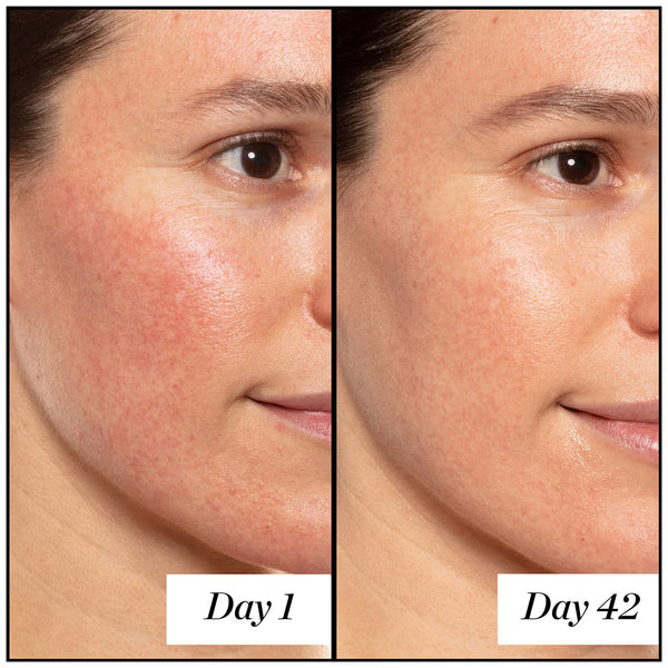 A+ High-Dose Retinoid Serum