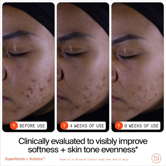 Superfruit Gentle Exfoliating Cleanser with Vitamin C + Papaya - GLAM MODA