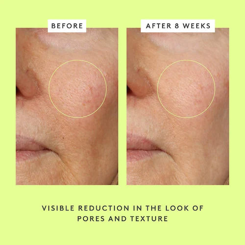 T.L.C. Framboos™ Glycolic Resurfacing Night Serum - GLAM MODA