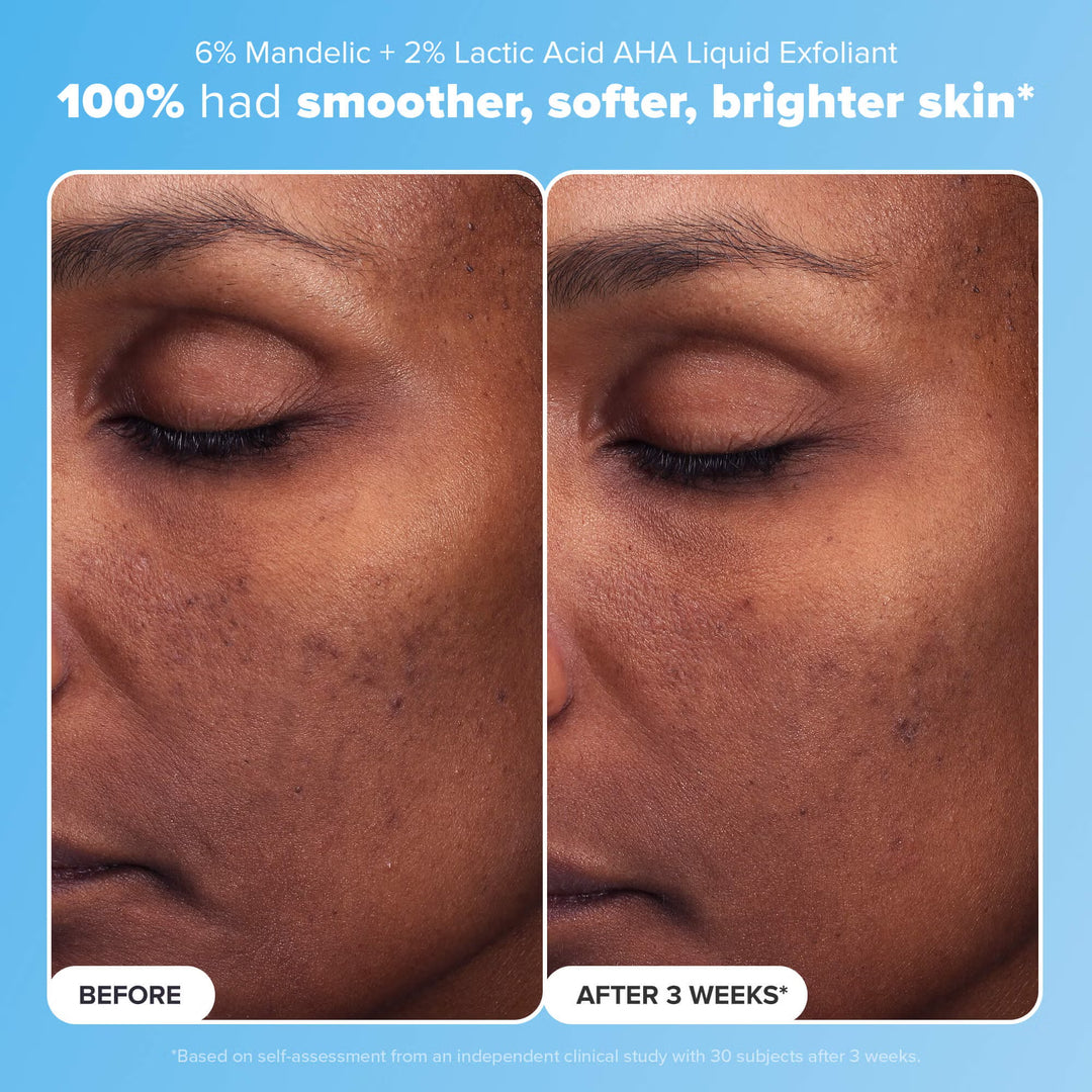 The Dew & Renew Kit - GLAM MODA