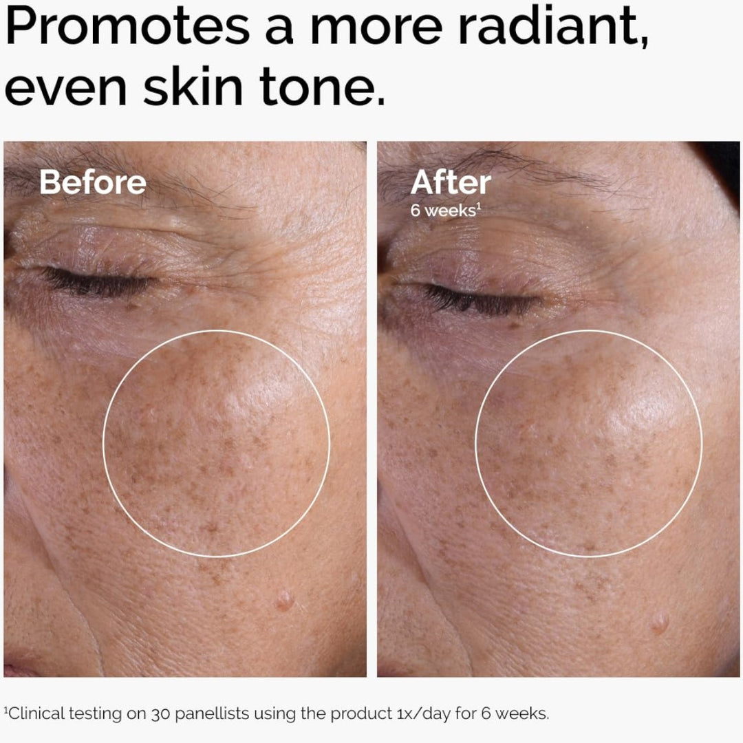 The Ordinary Glycolic Acid 7% Exfoliating Toner - GLAM MODA