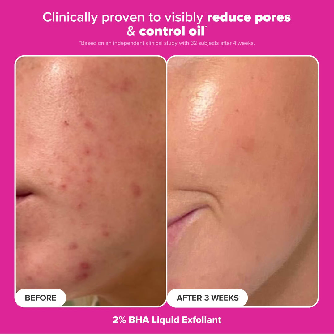 The Plump & Glow Kit - GLAM MODA