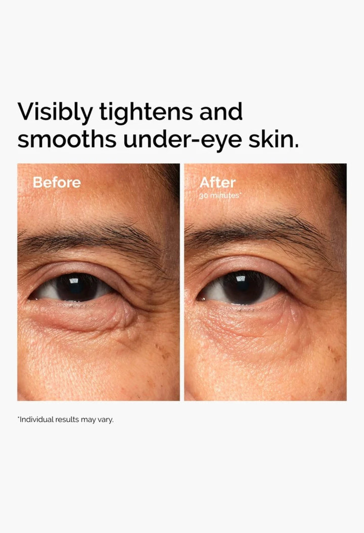 Lacto-PDRN* 4% + B9 Eye Cream