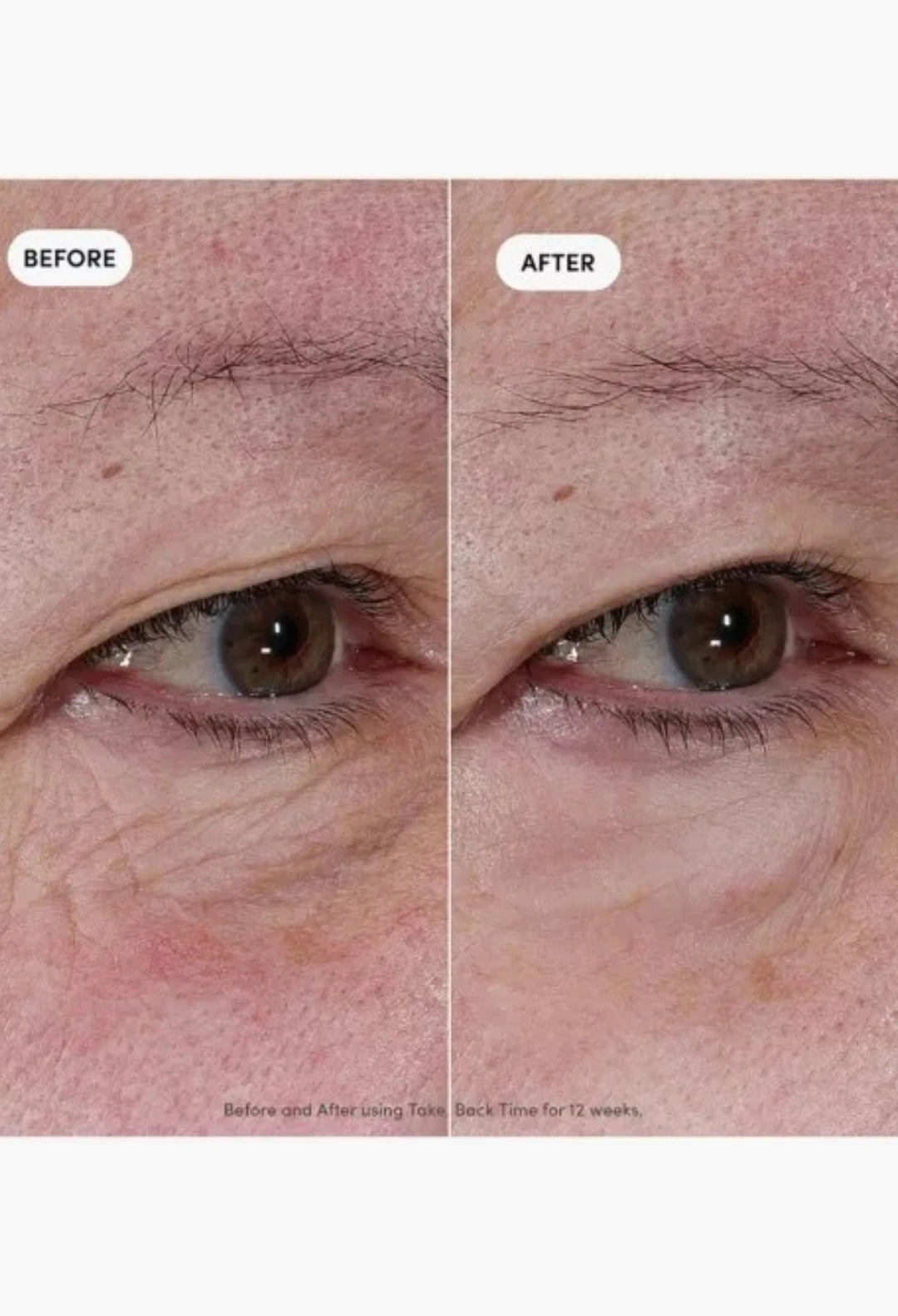 Take Back Time Miniprotein™ Eye Treatment